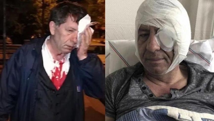 Saldırının ardından ilk yazısını yazdı: Korkmuyorum!