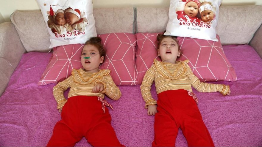 Hasta ikizlerin ailesi yardım bekliyor