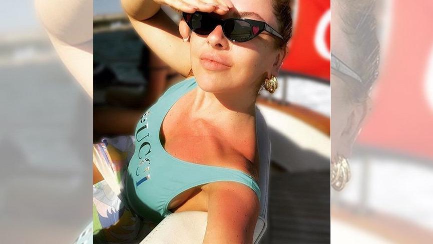 Hadise’den bir yaz günü karesi