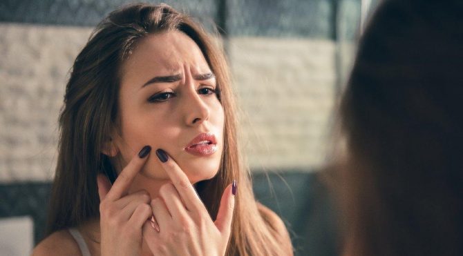 Sivilce nasıl geçer, neden olur? Sivilcelere dur deme zamanı geldi