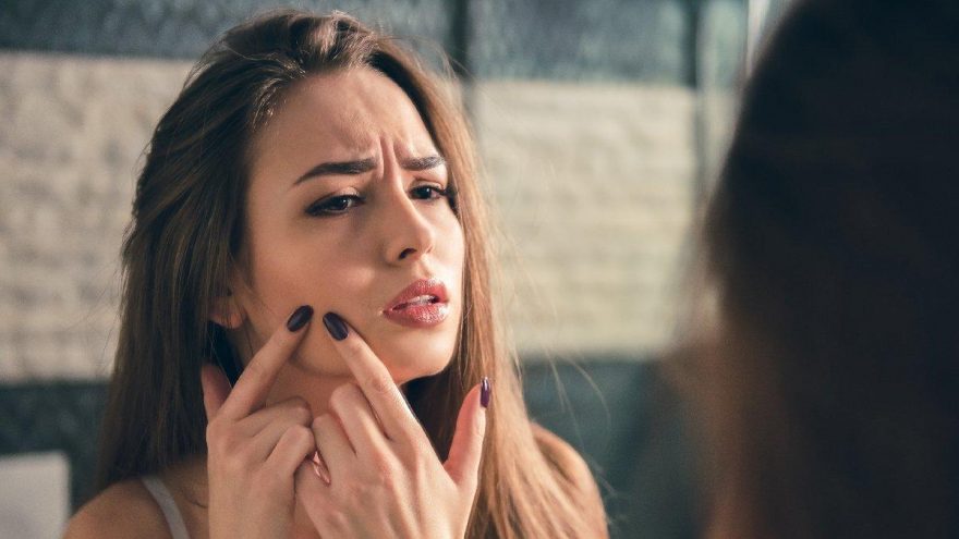 Sivilce nasıl geçer, neden olur? Sivilcelere dur deme zamanı geldi!