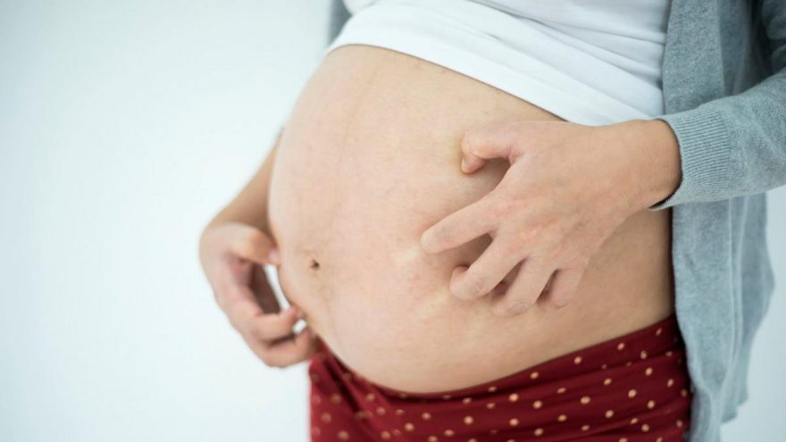 hamilelikte kasinti neden olur kasinti tedavisi guncel yasam haberleri