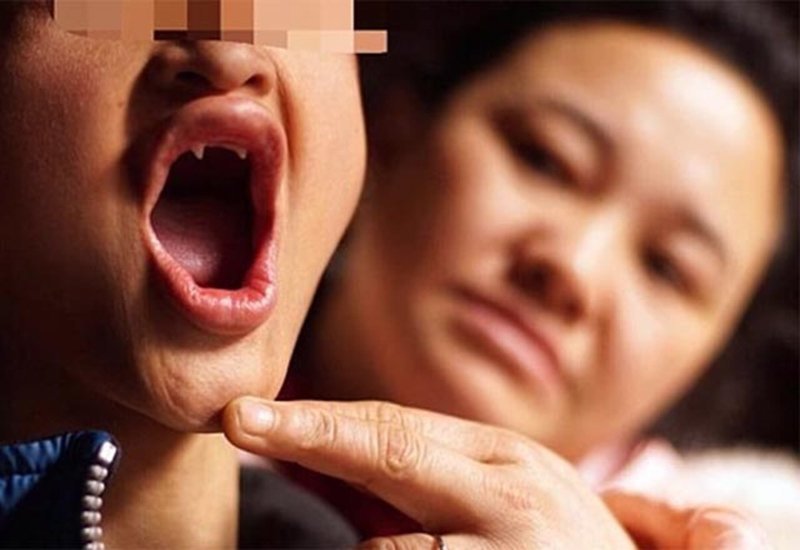 Vampir Hastalığı: Vampirlerin sahip olduğu özelliklerin sadece fantezi kitaplarında ve romanlarda gerçek olabileceğini düşünsekte, çok nadir görülen bir rahatsızlığa ‘Vampir Hastalığı’ adı verilir. Bu kişiler güneşe çıkamazlar. Güneşe çıktıklarında kusma ve mide bulantısı duyarlar. Aynı zamanda idrarları mor renkte gelmektedir. Aynı zamanda vampir hastalığı olan kişilerin dişlerinde ve ağızlarında şekil değişiklikleri meydana gelebilir.