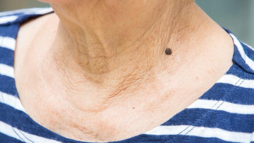Boyun kırışıklığına iyi gelen maske tarifi… Doğal boyun kırışıklığı maskesi nasıl yapılır?