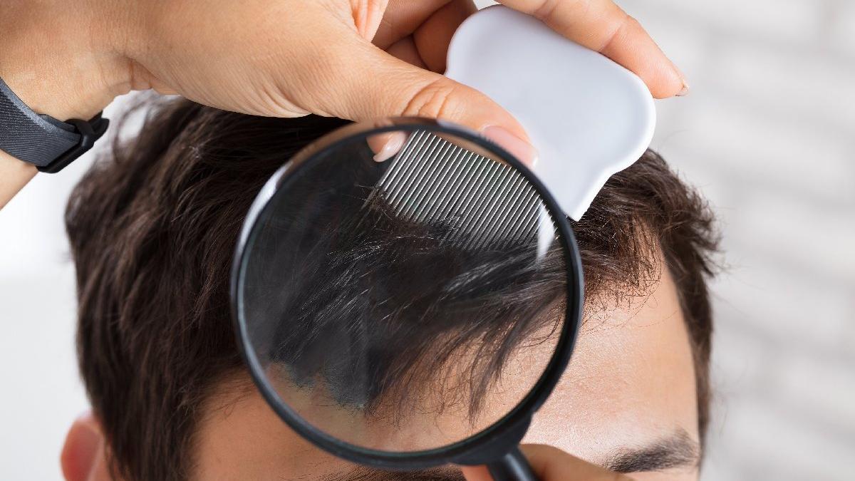 cocuklarda bit nasil anlasilir bit