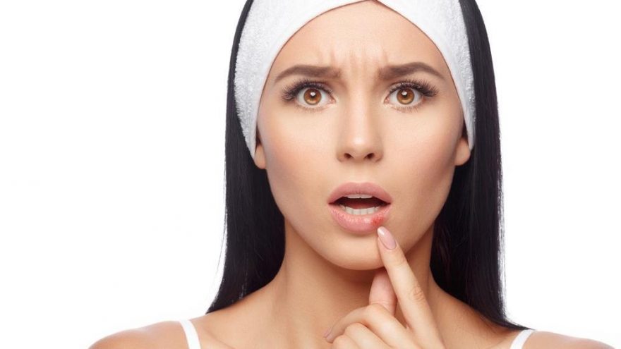 Uçuğa ne iyi gelir? Sık tekrarlayan uçuklardan kurtulma yolları…