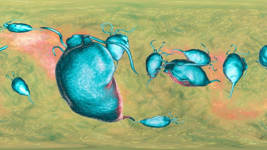 trikomonas enfeksiyonu nedir nedenleri