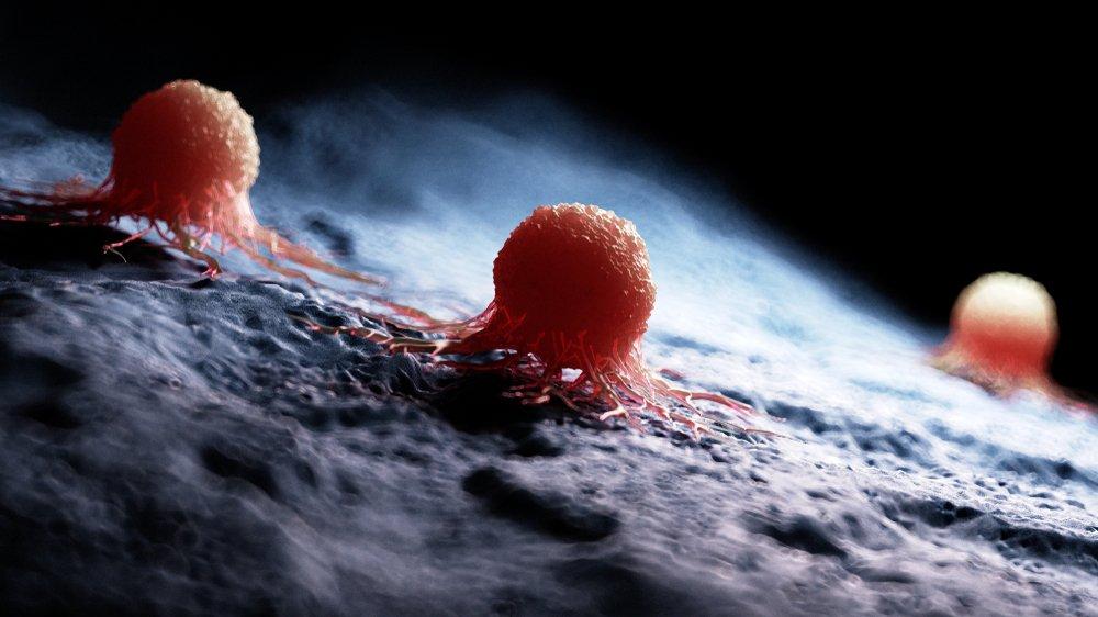 kanser hucreleri dukan diyeti mi