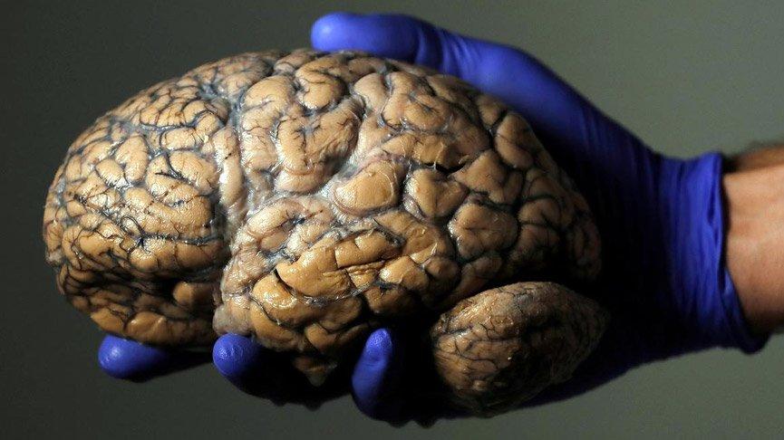 Bilim insanları, beynin yaşlanmasını yavaşlatmanın yolunu buldu