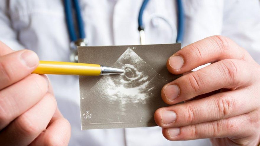 Pulmoner stenoz nedir? Belirtileri ve tedavisi…