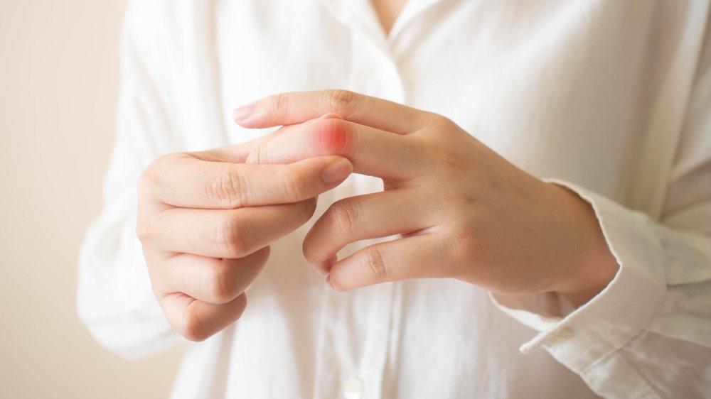 lupus hastaligi neden olur saglik