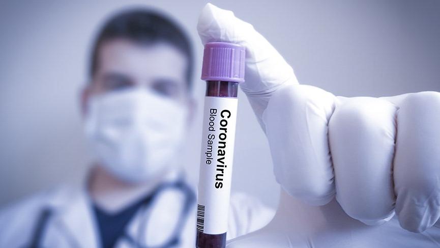 Azerbaycan’da ilk Corona virüsü vakası