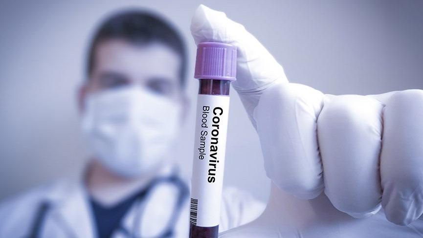 Koronavirüs Türkiye