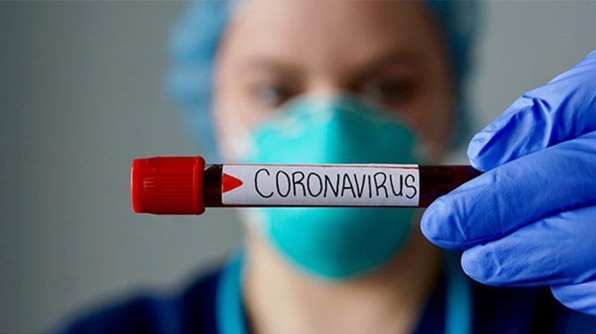 Corona Ile Mucadeleye Hangi Sirket Nasil Destek Oldu Ekonomi Haberleri
