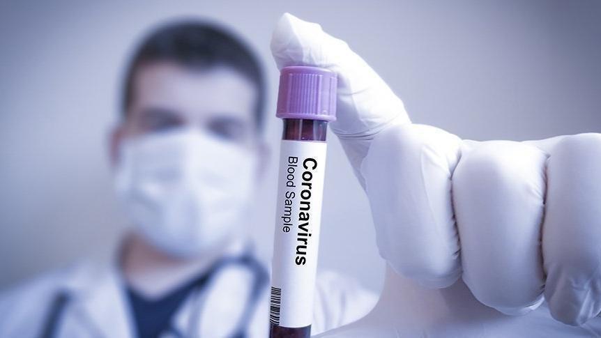 KKTC’de corona virüsü salgınında ikinci ölüm gerçekleşti