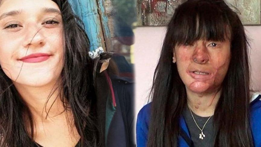 Berfin Özek, asitli saldırganı affetti!