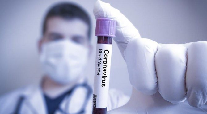 corona virus testi nasil yapilir corona testi hangi hastanelerde yapiliyor saglik son dakika haberler