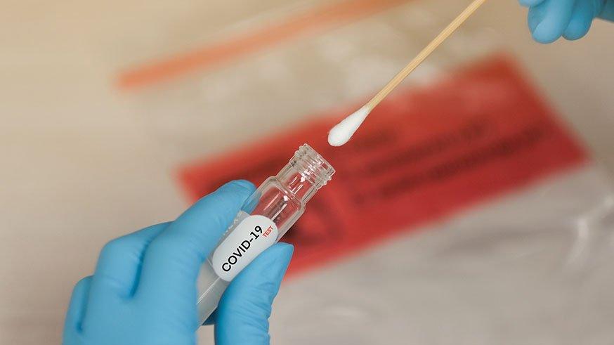 Türkiye’de corona virüsü haritası ne durumda? ABD artık liste başı oldu…