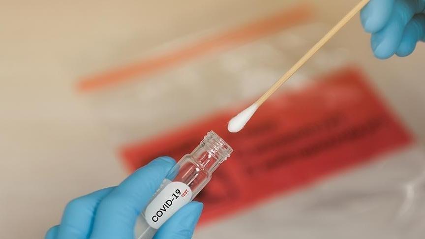 Virülans nedir? Virülans ne anlama gelir?