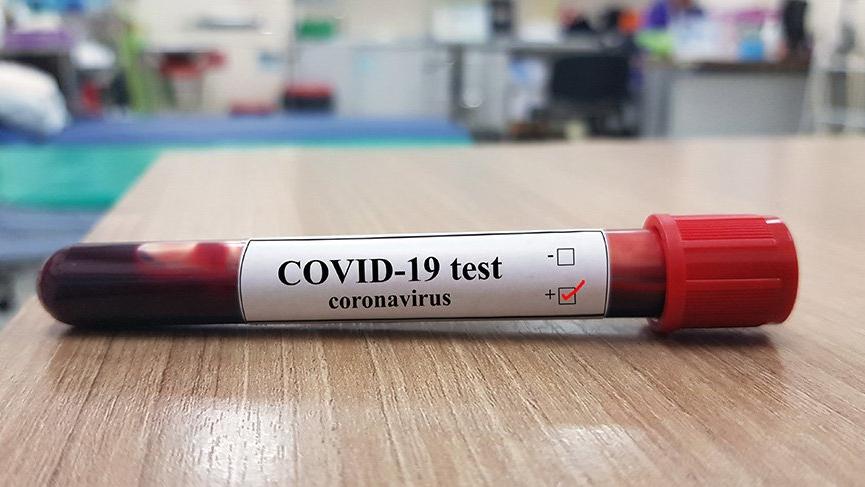 Balıkesir’de corona virüsü test sayısı 10 bini aştı