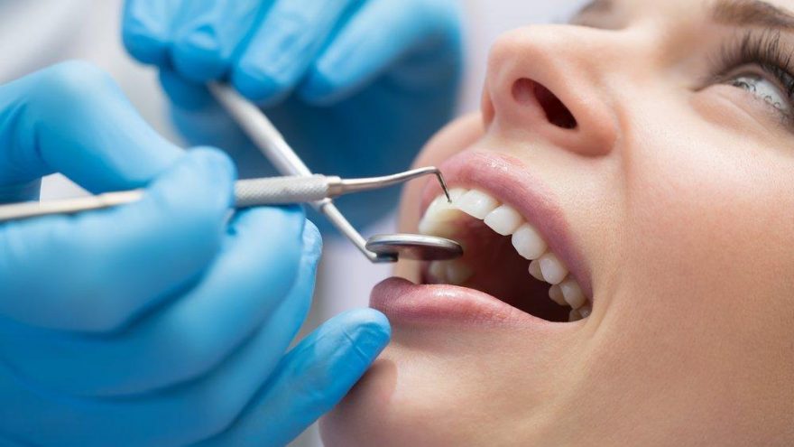 Diş minesi çatlaması için ne yapılabilir? Diş çatlağı tedavisi nasıl