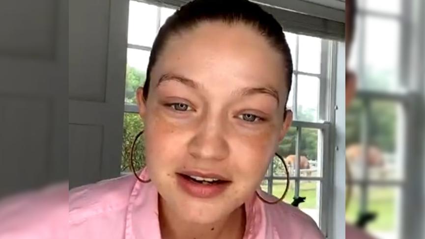 Gigi Hadid, estetik iddialarına cevap verdi