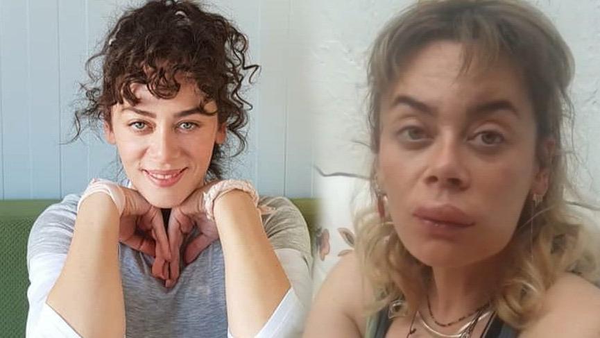 Demet Evgar’ın dudağını arı soktu