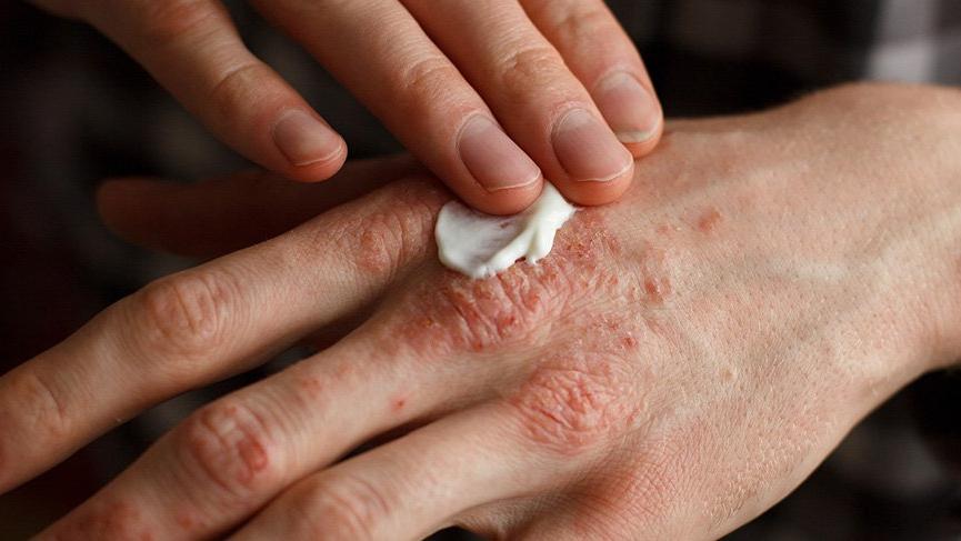 sedef hasta okulu canli yayinda covid