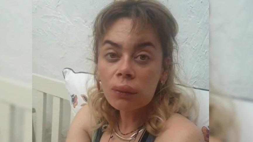 Demet Evgar, dudağından ve ayağından sokan arı için şarkı yaptı