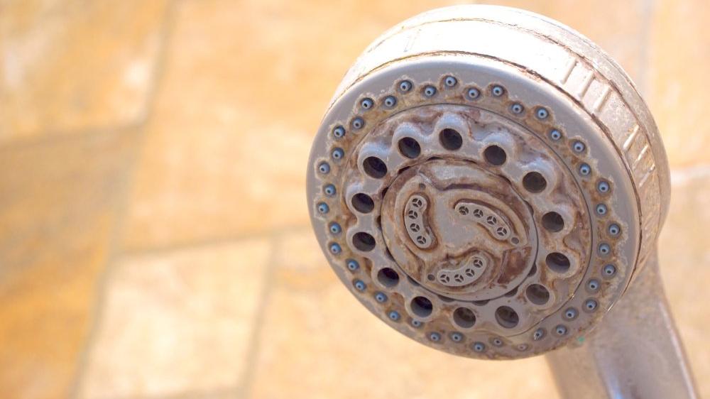 Pas Lekesi Nasil Cikar Guncel Yasam Haberleri