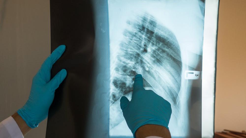 abd de ilk kez gerceklesti corona