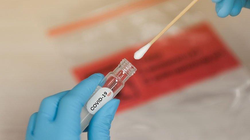 antikor testi nedir antikor testi ne ise yarar saglik son dakika haberler