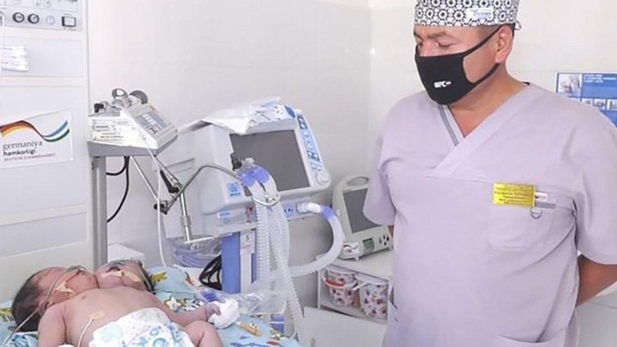Özbekistan’da çift başlı bebek muamması: İki beden tek vücutta gelişti