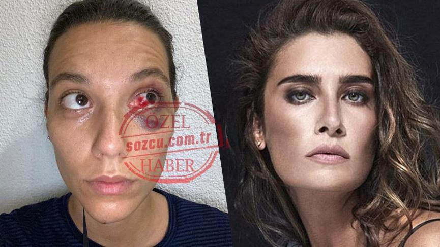 Ünlü isimlerden Ozan Güven’den şiddet gören Deniz Bulutsuz’a destek mesajları