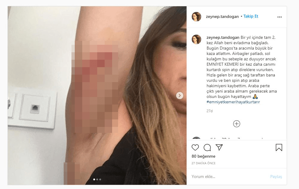 Sunucu Zeynep Tandogan Trafik Kazasi Gecirdi Guncel Yasam Haberleri