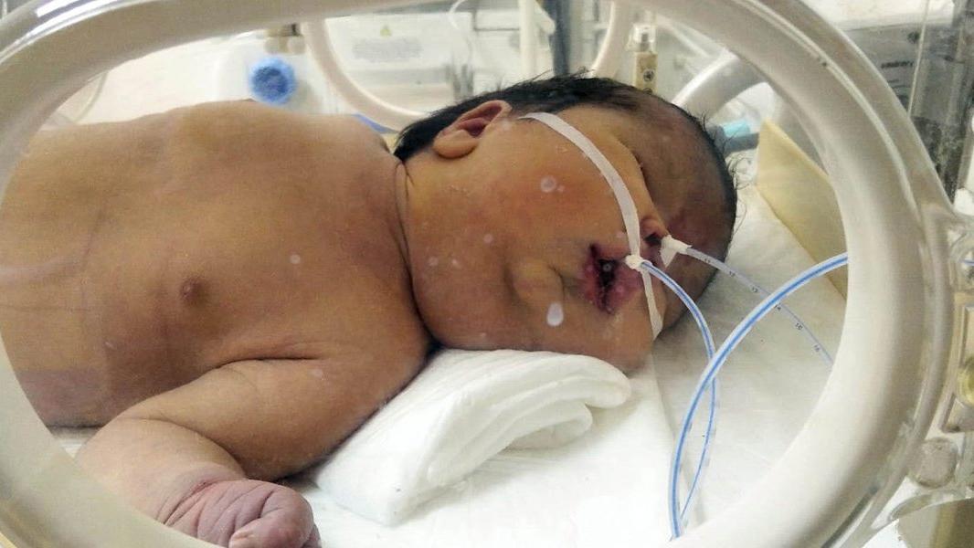 dogum raporunda erkek olan bebek kiz