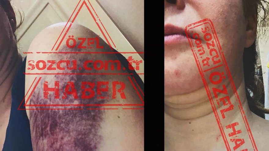Zeynep Çiller’den şok iddia! Eski başbakanın oğlu Mert Çiller eşi Zeynep Çiller’i bu hale getirmiş…