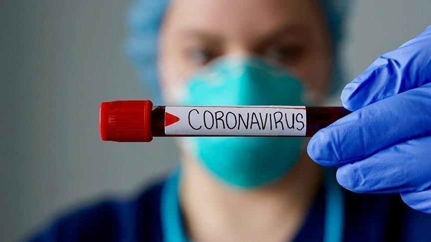 Corona Vaka Sayisi Kac Oldu 10 Agustos Guncel Vaka Sayisi Son Dakika Haberleri