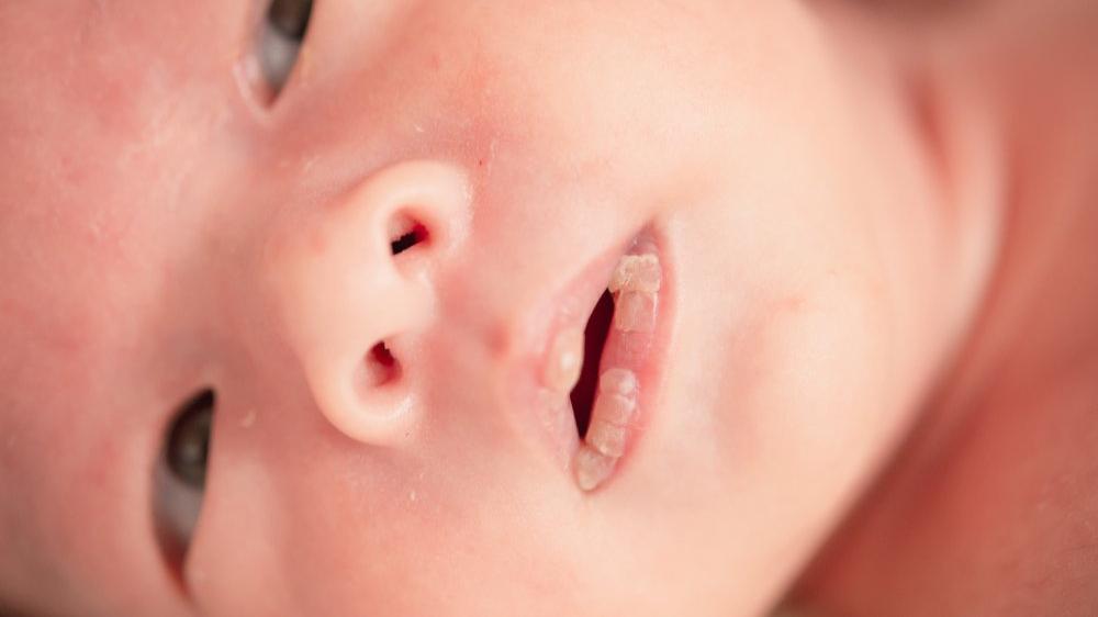 bebeklerde dudak kurumasi neden olur