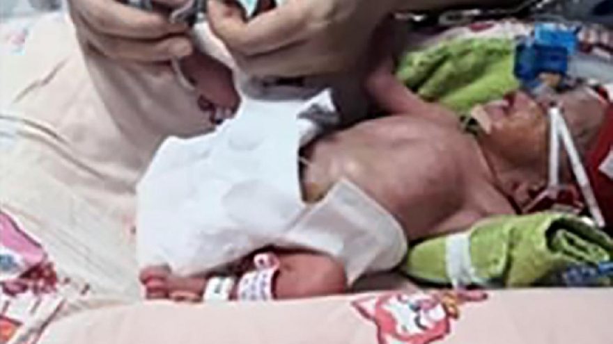 70 milyonda bir ihtimal gerçek oldu! Üç kez düşükten sonra dördüz doğurdu