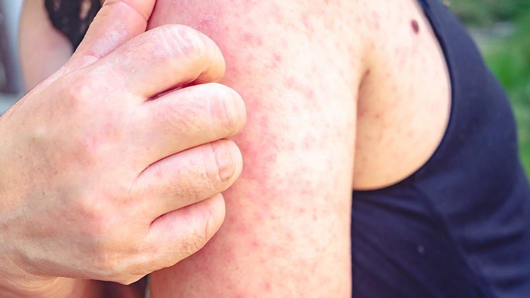 prof dr oguzturk uyardi deride