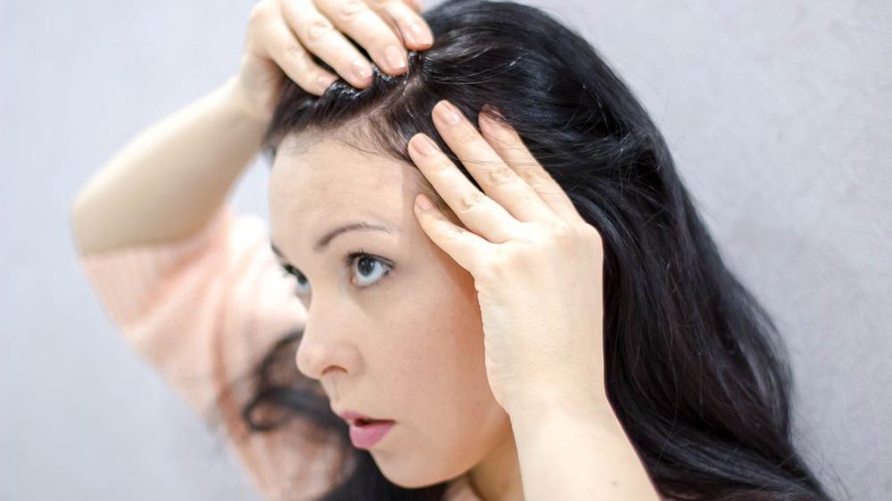 sac diplerinde neden sivilce olusur