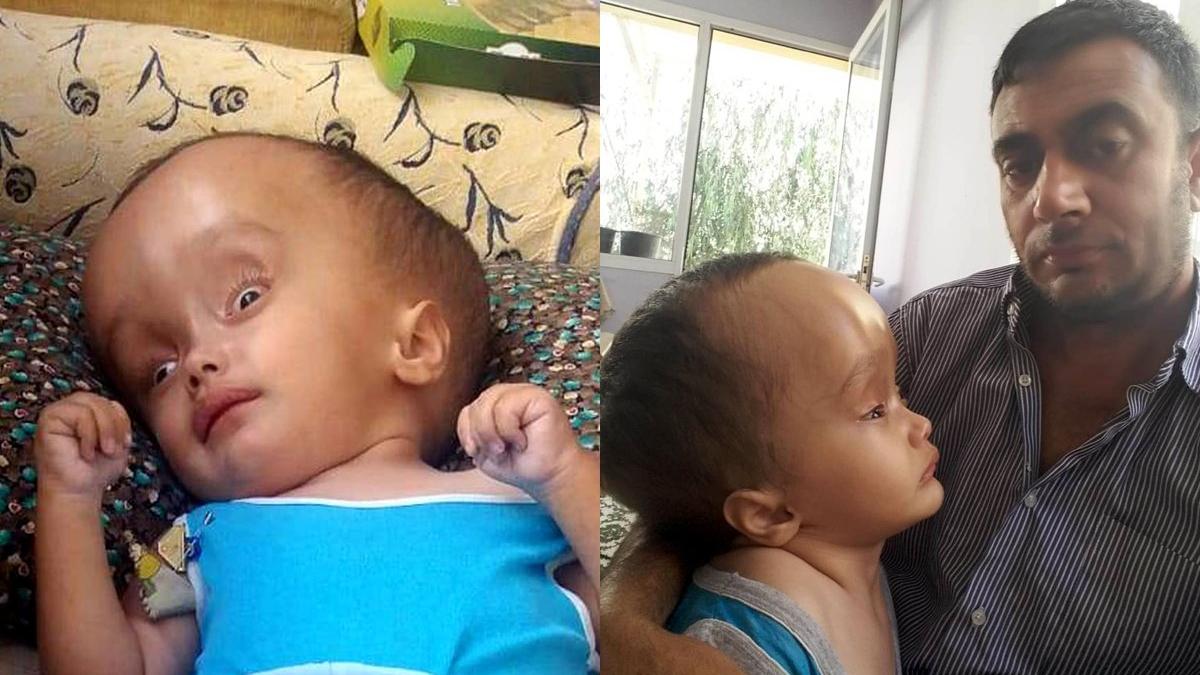 ellerimde olmesinden korkuyorum