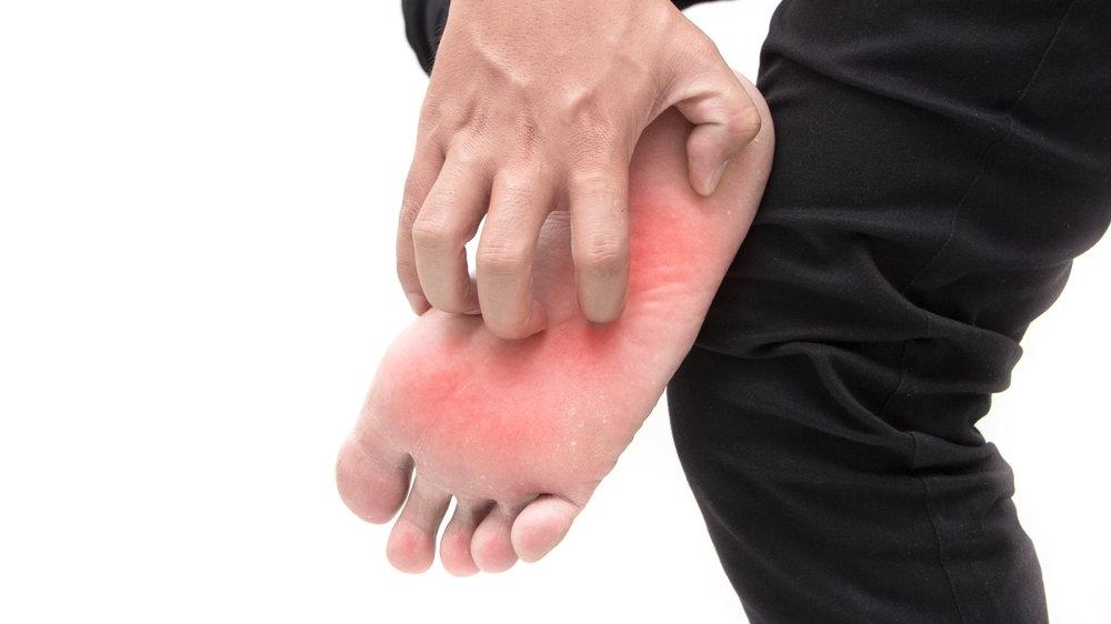 ayak alti yanmasi icin hangi bolum