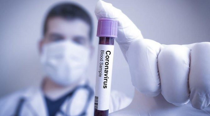Corona Virusu Yorgunluk Yapar Mi Covid 19 Belirtileri Saglik Son Dakika Haberler