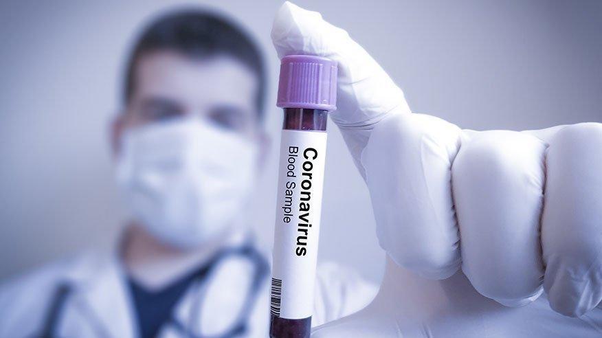 corona virusu yorgunluk yapar mi covid 19 belirtileri saglik son dakika haberler