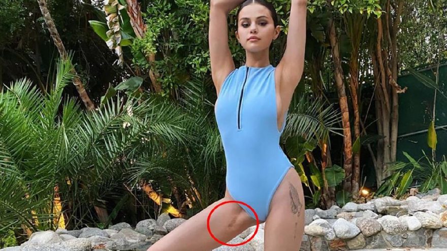 Selena Gomez’den dikkat çeken paylaşım! Yıllar sonra ilk kez yarasını gösterdi