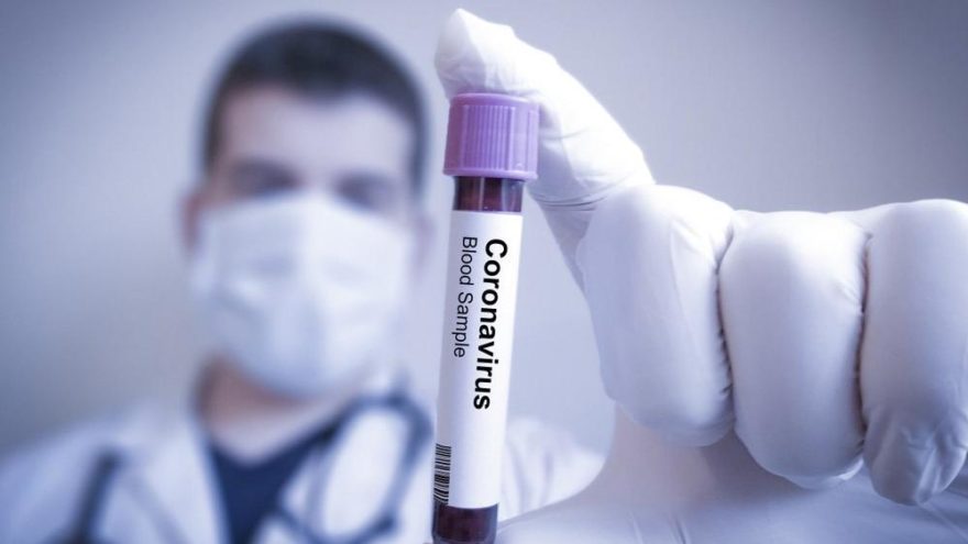 20 Ekim corona virüsü tablosundaki son durum nedir?