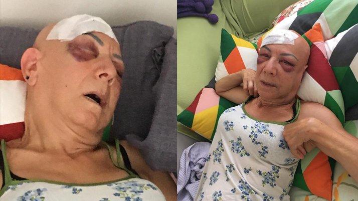 Kayınvalidesini vuran damada 8 yıl hapis