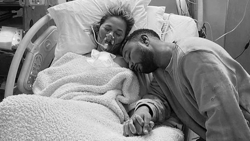 Bebeğini kaybeden Chrissy Teigen o fotoğrafları anlattı: Yaşadım ve yaptım